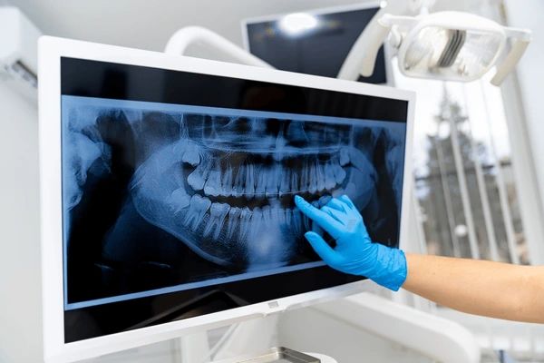 digital x-rays near you