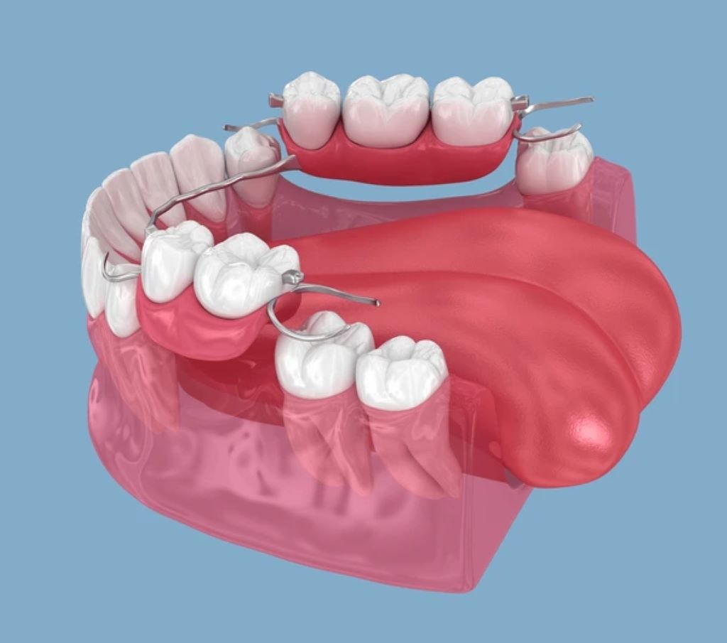 full or partial dentures near you