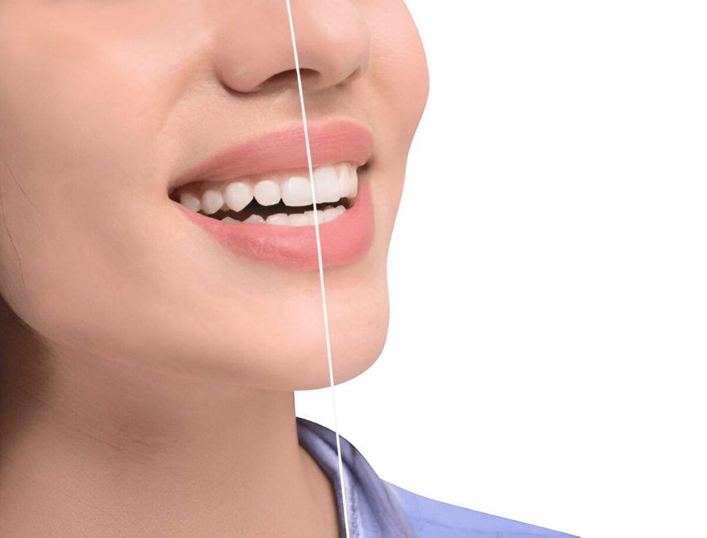 gum contouring in encino ca