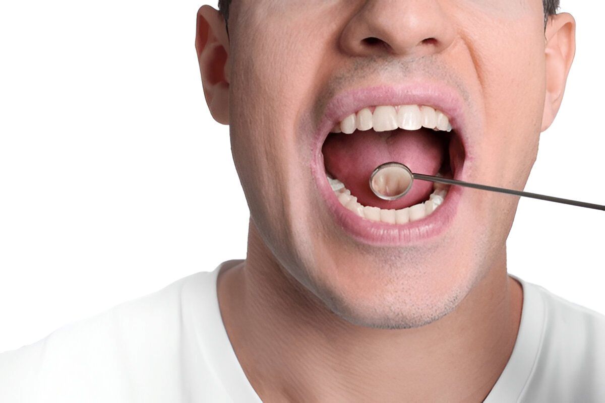 oral cancer screenings in encino ca