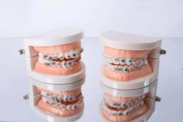 orthodontics in encino ca