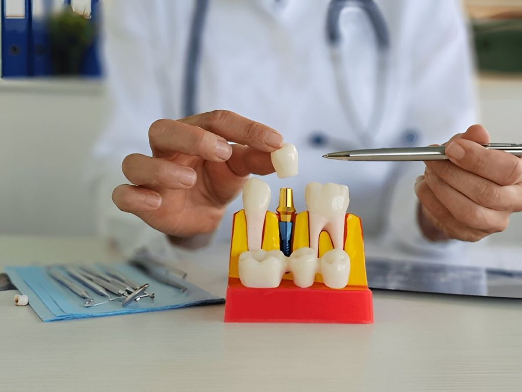 porcelain crowns in encino ca