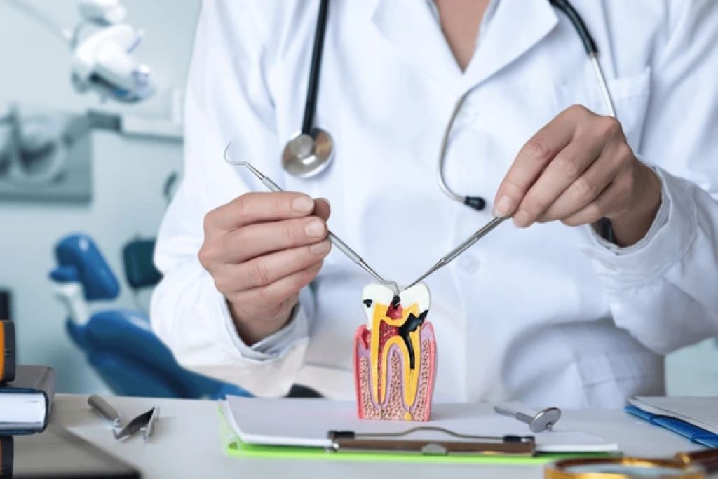 root canal therapy in encino ca