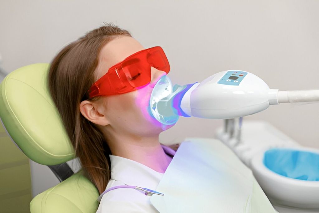 teeth whitening in encino ca