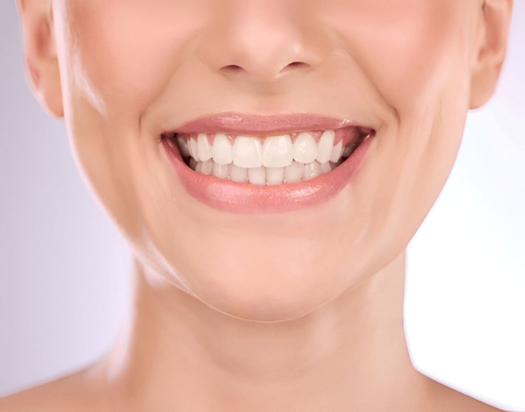 teeth whitening near you