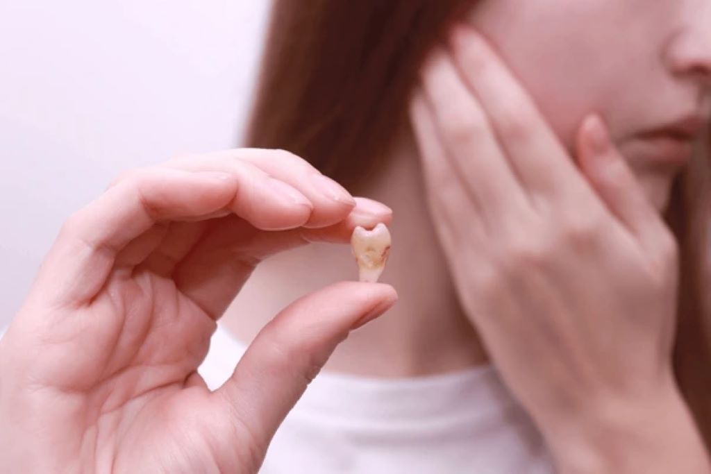 wisdom teeth removal in encino ca