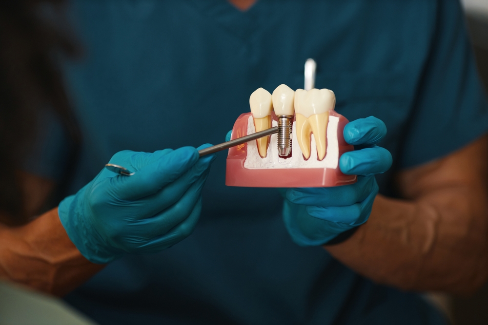 all on 4 dental implants vs traditional dentures which is better